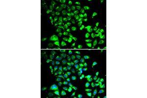 Immunofluorescence analysis of U2OS cells using SSBP1 antibody (ABIN5974202). (SSBP1 antibody)
