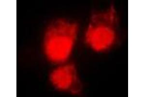 Immunofluorescent analysis of CDC2 (pT161) staining in HeLa cells. (CDK1 antibody  (pSer161))