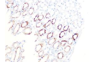 Immunohistochemistry of paraffin-embedded mouse kidney using PDHB Rabbit mAb (ABIN7269772) at dilution of 1:100 (40x lens). (PDHB antibody)