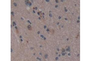 Figure. (PLA2G4D antibody  (AA 9-120))