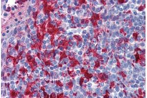 Human Tonsil: Formalin-Fixed, Paraffin-Embedded (FFPE) (Gelsolin antibody  (AA 542-591))