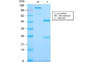 SDS-PAGE Analysis Purified CD79b Recombinant Rabbit Monoclonal Antibody (IGB/2940R). (Recombinant CD79b antibody  (AA 29-159))