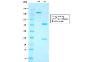 SDS-PAGE analysis of purified, BSA-free recombinant CD79a antibody (clone IGA/1790R) as confirmation of integrity and purity.