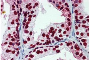 Human Prostate: Formalin-Fixed, Paraffin-Embedded (FFPE) (FOXA1 antibody  (AA 367-473))