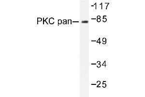 Image no. 1 for anti-Protein Kinase C, alpha (PKCa) antibody (ABIN272065)