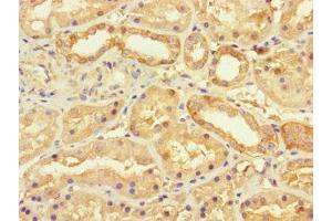 Immunohistochemistry of paraffin-embedded human kidney tissue using ABIN7175490 at dilution of 1:100