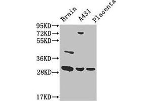 Western Blot Positive WB detected in: Mouse brain tissue, A431 whole cell lysate, Human placenta tissue All lanes: YWHAG antibody at 3. (14-3-3 gamma antibody  (AA 113-194))