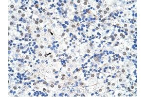 IKZF3 antibody was used for immunohistochemistry at a concentration of 4-8 ug/ml to stain Hepatocytes (arrows) in Human Liver. (IKZF3 antibody  (N-Term))