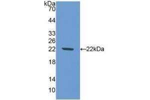 Detection of Recombinant NOS1, Mouse using Polyclonal Antibody to Nitric Oxide Synthase 1, Neuronal (NOS1) (NOS1 antibody  (AA 53-247))