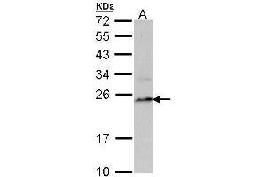 WB Image Sample (30 ug of whole cell lysate) A: Raji 12% SDS PAGE antibody diluted at 1:1000