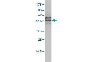 EIF5 monoclonal antibody (M01), clone 2E6-4C12 Western Blot analysis of EIF5 expression in Jurkat . (EIF5 antibody  (AA 1-431))