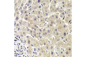 Immunohistochemistry of paraffin-embedded Human liver injury using AKT1S1 antibody at dilution of 1:100 (x400 lens).