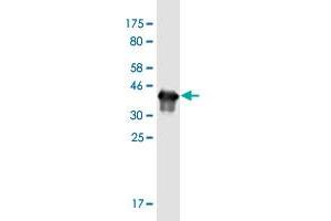 Western Blot detection against Immunogen (37. (Gastrin antibody  (AA 1-101))