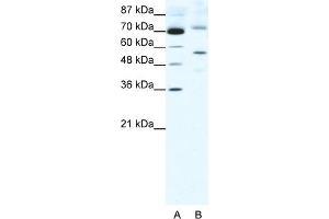WB Suggested Anti-SIRT3 Antibody Titration:  2. (SIRT3 antibody  (Middle Region))