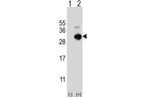 Western Blotting (WB) image for anti-Glutathione S-Transferase omega 1 (GSTO1) antibody (ABIN3001725) (GSTO1 antibody)