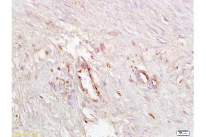 Formalin-fixed and paraffin embedded human endometrial tissue labeled with Anti ICAM4 Polyclonal Antibody, Unconjugated (ABIN873300) at 1:200 followed by conjugation to the secondary antibody and DAB staining (ICAM4 antibody  (AA 85-180))