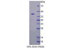 SDS-PAGE (SDS) image for General Transcription Factor IIIA (GTF3A) (AA 71-365) protein (His tag) (ABIN4990099) (GTF3A Protein (AA 71-365) (His tag))