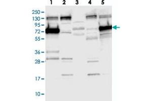 Western blot analysis of Lane 1: RT-4, Lane 2: U-251 MG, Lane 3: Human Plasma, Lane 4: Liver, Lane 5: Tonsil with SYTL1 polyclonal antibody . (SYTL1 antibody)