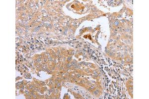 Immunohistochemistry (IHC) image for anti-Cyclin-Dependent Kinase 20 (CDK20) antibody (ABIN3016460) (CCRK antibody)