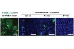 Infection of human lung cell line, HCT-8 from irradiated and untreated hCoV-OC43. (hCoV-OC43 Spike antibody  (AA 15-344))