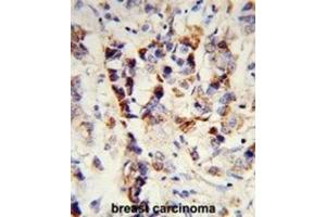 Immunohistochemistry (IHC) image for anti-Superkiller Viralicidic Activity 2-Like 2 (SKIV2L2) antibody (ABIN3003891) (MTR4 antibody)