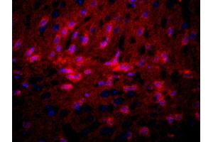 Formalin-fixed and paraffin-embedded mouse brain labeled with Rabbit Anti-GPR10 Polyclonal Antibody, Unconjugatedused at 1:200 dilution for 40 minutes at 37°C. (PRLHR antibody  (AA 161-260))
