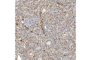IHC analysis of TXNDC5 using anti-TXNDC5 antibody (ABIN7599699). (TXNDC5 antibody  (AA 109-403))