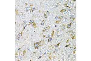 Immunohistochemistry of paraffin-embedded mouse brain using PDYN antibody (ABIN6129606, ABIN6145418, ABIN6145419 and ABIN6221524) at dilution of 1:100 (40x lens). (PDYN antibody  (AA 21-254))