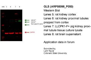 Western Blotting (WB) image for anti-Glutaminase (GLS) (C-Term) antibody (ABIN2786054) (Glutaminase antibody  (C-Term))