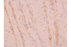 DAB staining on IHC-P; Samples: Human Kidney Tissue (ALOX15 antibody  (AA 170-312))