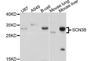 Western blot analysis of extracts of various cell lines, using SCN3B antibody (ABIN4905097) at 1:1000 dilution. (SCN3B antibody)