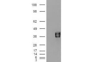 HEK293T cells were transfected with the pCMV6-ENTRY control (Left lane) or pCMV6-ENTRY EpCAM (RC201989) (Right lane) cDNA for 48 hrs and lysed. (EpCAM antibody  (AA 24-265))