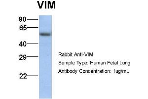 Host:  Rabbit  Target Name:  VIM  Sample Type:  Human Fetal Lung  Antibody Dilution:  1. (Vimentin antibody  (C-Term))