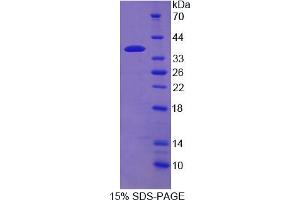 Image no. 1 for Calcium/calmodulin-Dependent Protein Kinase II gamma (CAMK2G) (AA 14-301) protein (His tag) (ABIN6236679)