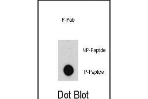 Dot blot analysis of anti-ABL-p Pab (R) on nitrocellulose membrane. (ABL1 antibody  (pTyr204))