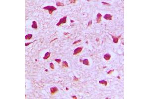 Immunohistochemical analysis of RANBP6 staining in human brain formalin fixed paraffin embedded tissue section. (RANBP6 antibody  (Center))