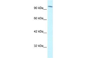 Human Jurkat; WB Suggested Anti-SMARCC1 Antibody Titration: 1. (SMARCC1 antibody  (C-Term))