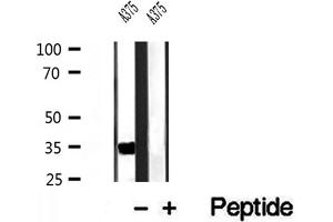 DHRS3 antibody  (Internal Region)