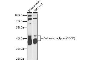 Western blot analysis of extracts of various cell lines, using Delta-sarcoglycan (Delta-sarcoglycan (SGCD)) antibody (ABIN6130325, ABIN6147699, ABIN6147701 and ABIN6217312) at 1:1000 dilution.