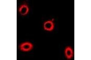 Immunofluorescent analysis of HIP1 staining in U2OS cells. (HIP1 antibody)
