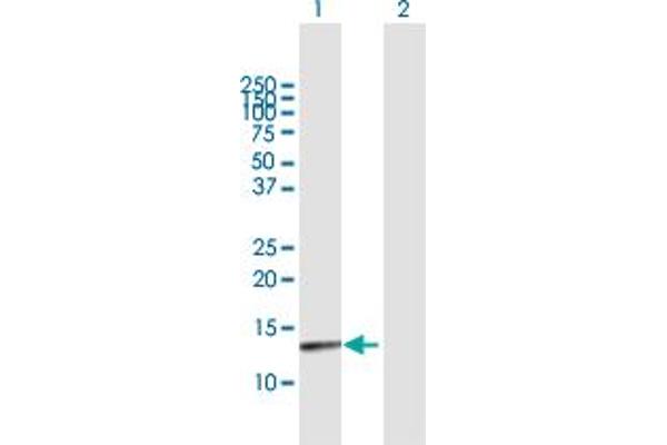 PTS antibody  (AA 1-145)