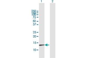 Western Blot analysis of PTS expression in transfected 293T cell line by PTS MaxPab polyclonal antibody. (PTS antibody  (AA 1-145))