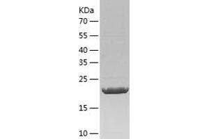 Western Blotting (WB) image for Coiled-Coil Domain Containing 25 (CCDC25) (AA 1-208) protein (His tag) (ABIN7122429) (CCDC25 Protein (AA 1-208) (His tag))