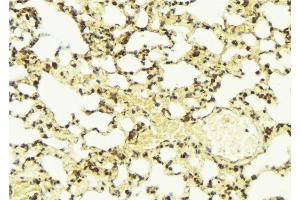 ABIN6274326 at 1/100 staining Mouse lung tissue by IHC-P. (AKAP13 antibody  (Internal Region))