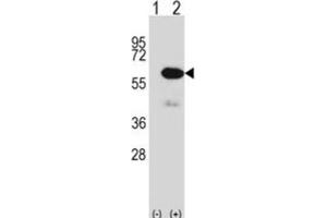 Western Blotting (WB) image for anti-Methionyl Aminopeptidase 2 (METAP2) antibody (ABIN2997955) (METAP2 antibody)