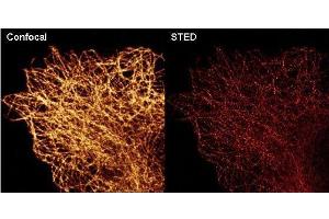 Immunofluorescence (IF) image for anti-Tubulin, alpha 1B (TUBA1B) (C-Term) antibody (ABIN964563)