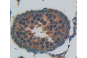 Figure. (PTX3 antibody  (AA 195-381))