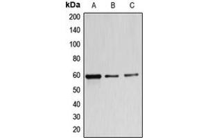Western blot analysis of B4GALNT1 expression in MDAMB453 (A), A549 (B), K562 (C) whole cell lysates. (B4GALNT1 antibody  (Center))