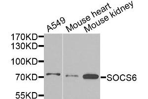 Western blot analysis of extracts of various cell lines, using SOCS6 antibody. (SOCS6 antibody)