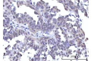 IHC analysis of RBM22 using anti-RBM22 antibody (ABIN7600268).
